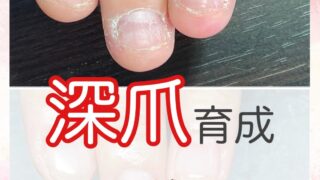 深爪育成2ヶ月後の変化
